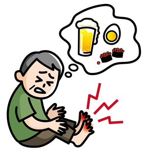 高尿酸血症(痛風)